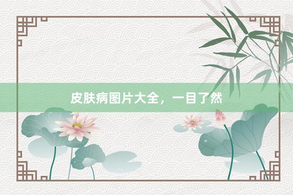 皮肤病图片大全，一目了然